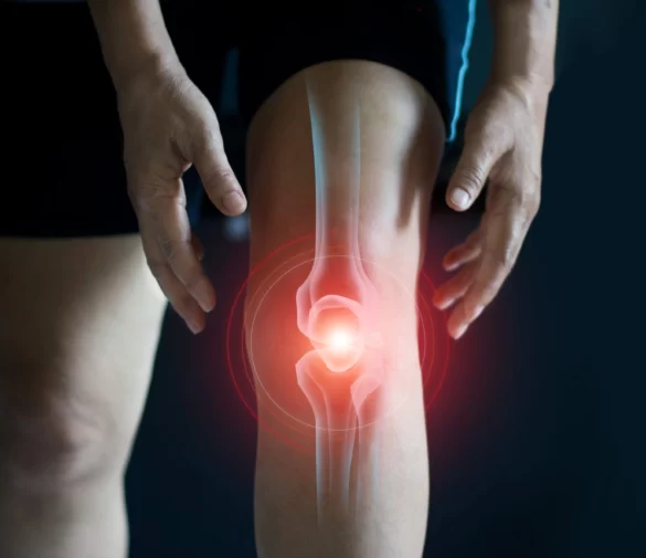 CBD mot ledvärk – Lindra din kroniska smärta!